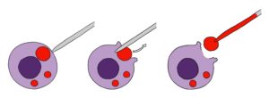 Lysosomal patch clamp technique